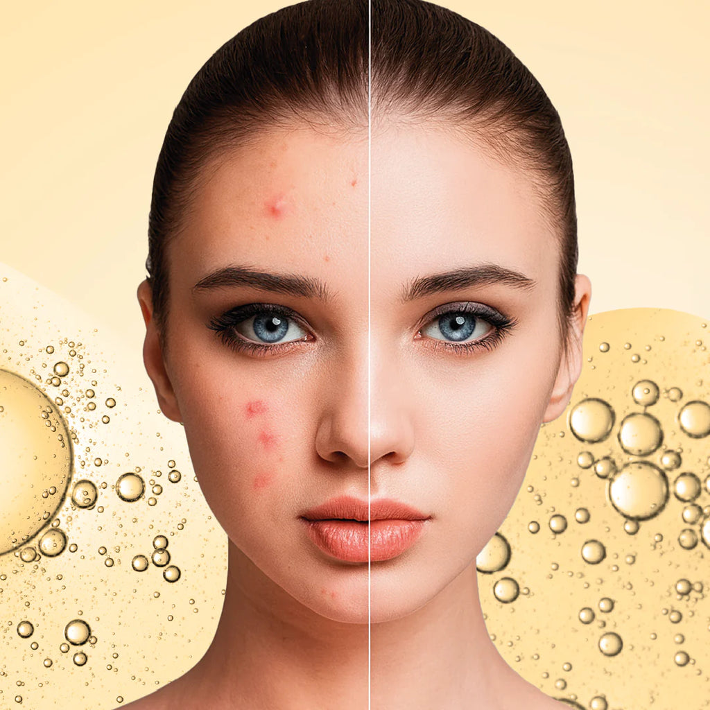 SERUM NIACINAMIDA 10%