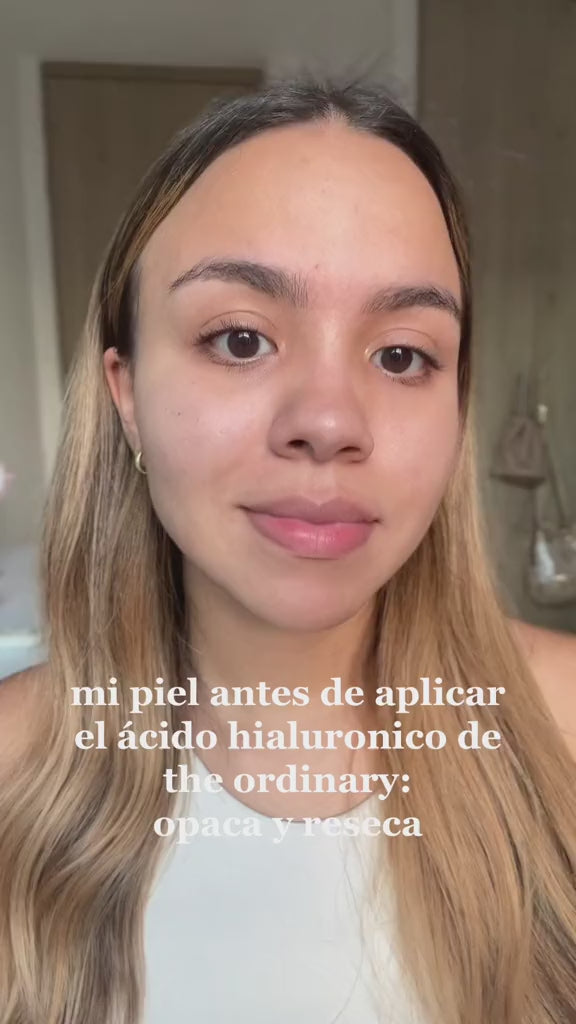 ÁCIDO HIALURÓNICO 2%