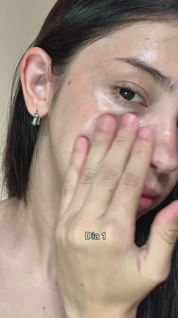 SERUM VITAMINA C